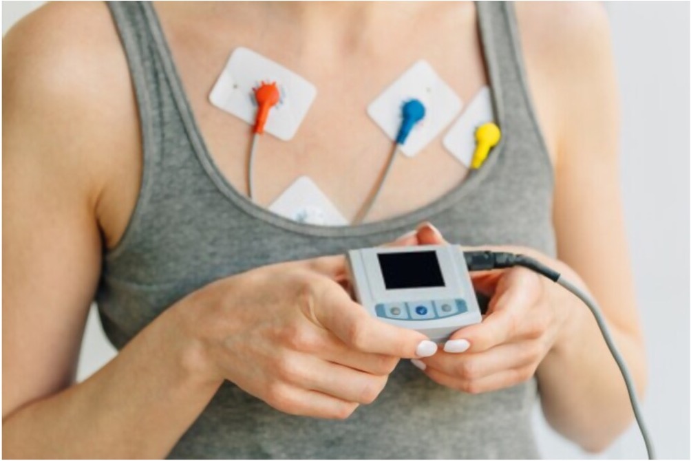 ECG Holter delle 24 ore